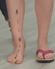 Daryl™| Orthopedic Sandals
